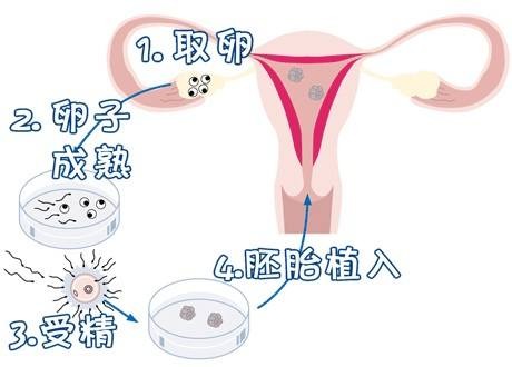 关于代生儿子包性别